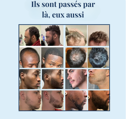Sérum roll-on pour la croissance des cheveux
