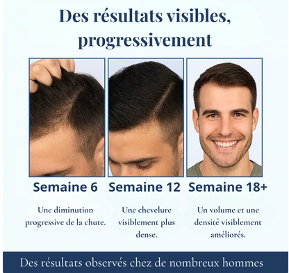 Sérum roll-on pour la croissance des cheveux
