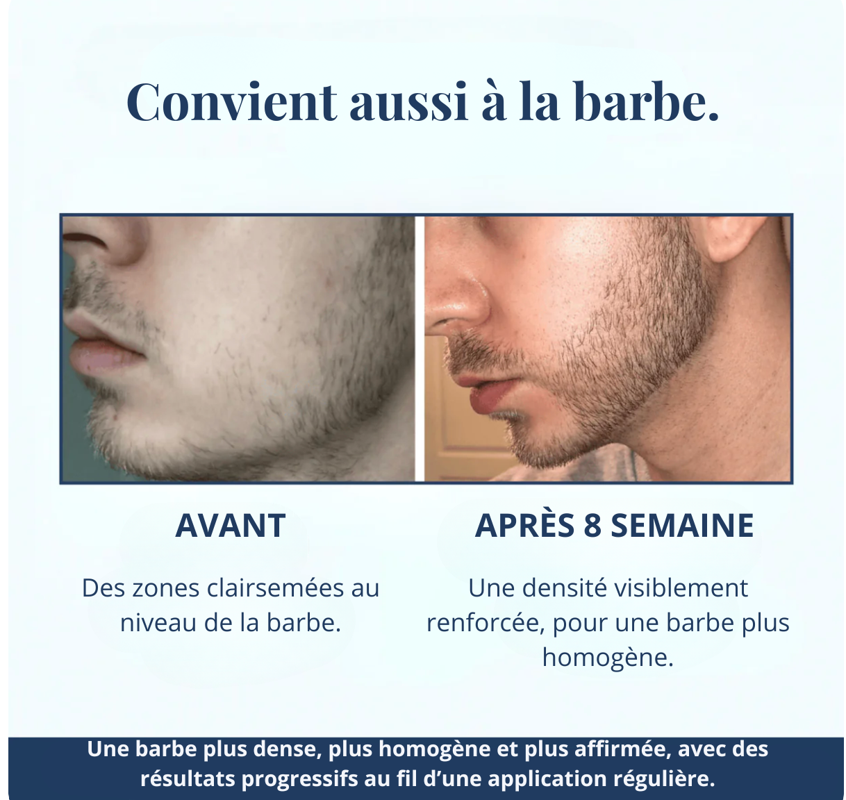 Sérum roll-on pour la croissance des cheveux